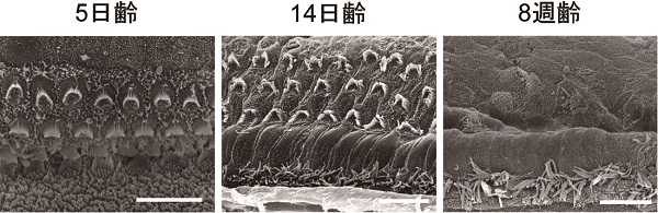 Atg5欠損有毛細胞における走査型電子顕微鏡所見 © 2017 Chisato Fujimoto.14日齢以降において細胞の障害が進行している。スケールバー: 10 µm.