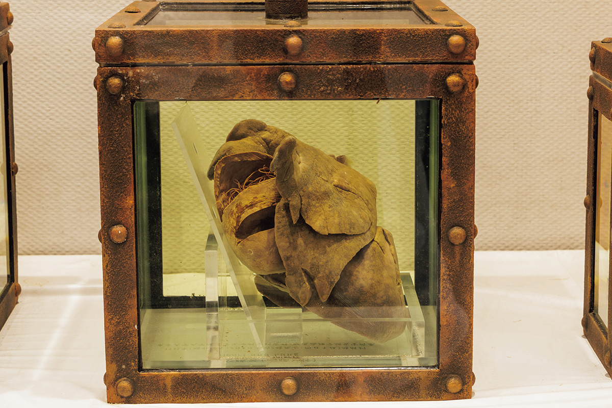 Hachiko’s lungs and heart